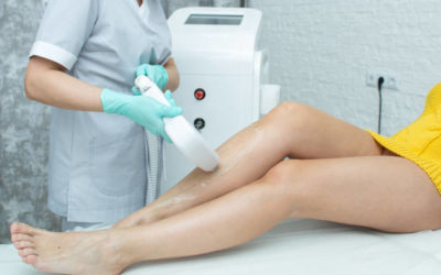 Épilation laser Villefranche : L’épilation au laser peut-elle aider la kératose pilaire ?