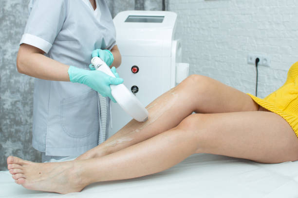 Épilation laser Villefranche : L’épilation au laser peut-elle aider la kératose pilaire ?