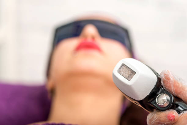 Épilation pour femme a Lyon : Quelle est la meilleure technique d’épilation pour les peaux sensibles ?