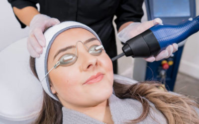 Laser de rajeunissement Lyon :Quels sont les effets secondaires potentiels du laser de rajeunissement?