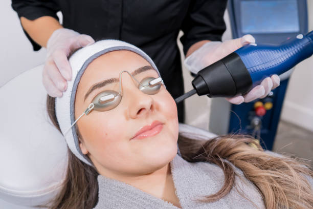 Laser de rajeunissement Lyon :Quels sont les effets secondaires potentiels du laser de rajeunissement?