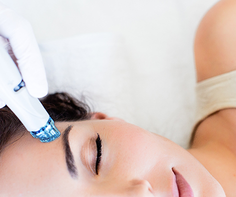 L’épilation laser : Quels sont les critères pour déterminer l’intensité du laser en fonction du type de peau à Villefranche ?