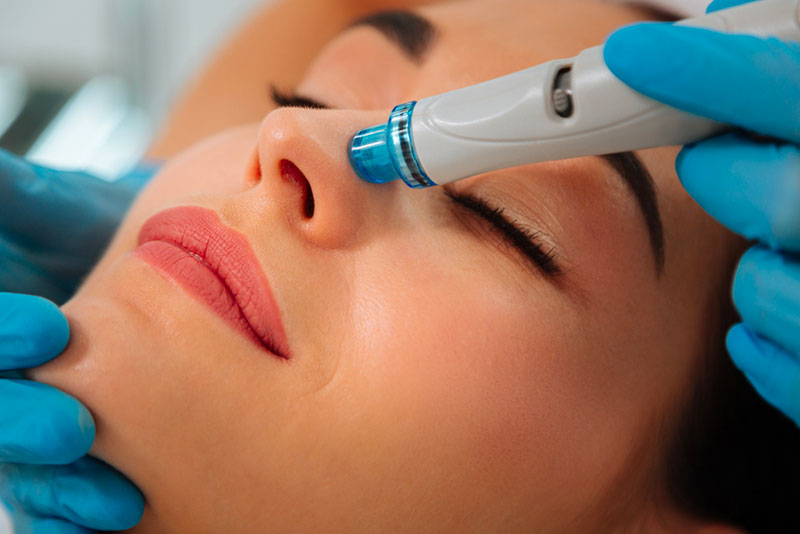 Qu’est-ce que l’Hydrafacial Perk ? Un Regard Approfondi sur ce Soin Révolutionnaire à Lyon