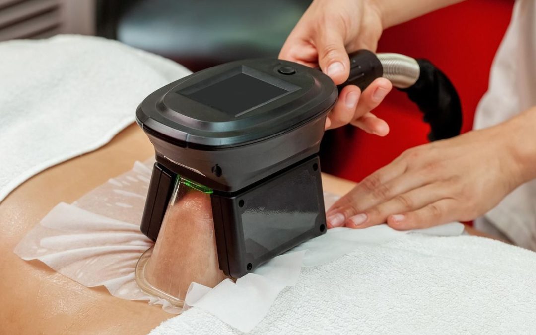Comment la cryolipolyse cible-t-elle les cellules graisseuses ?