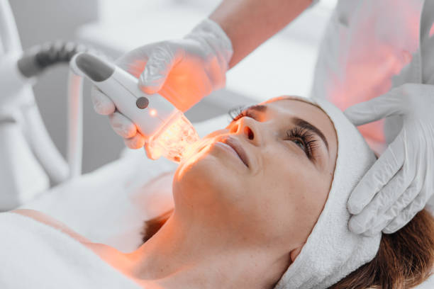 Les traitements laser peuvent-ils remplacer le Botox et les fillers ?