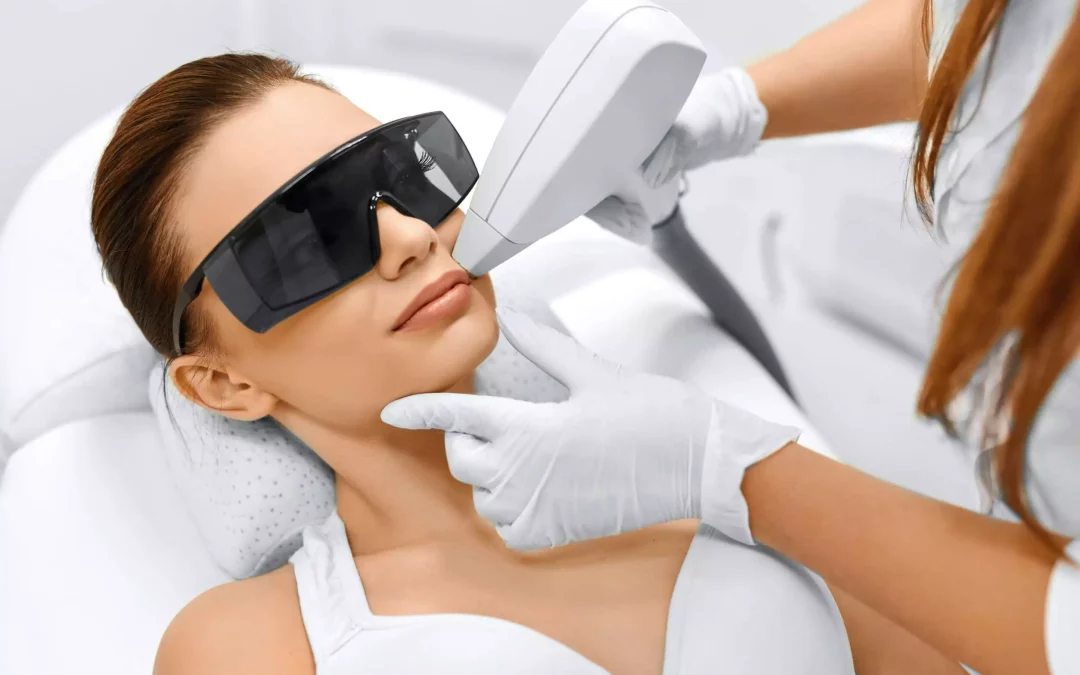 Quelle est la meilleure saison pour commencer l’épilation laser ?