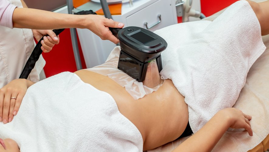 Comment la cryolipolyse cible-t-elle spécifiquement les cellules graisseuses?
