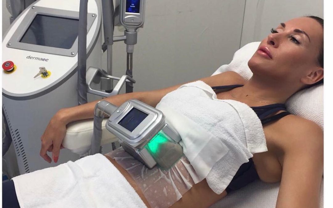 Cryolipolyse Ville Franche : Découvrez le Timing des Premiers Résultats