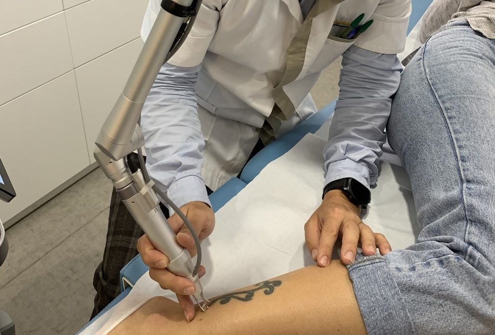 Quels sont les risques de pigmentation après un détatouage laser Villefranche ?