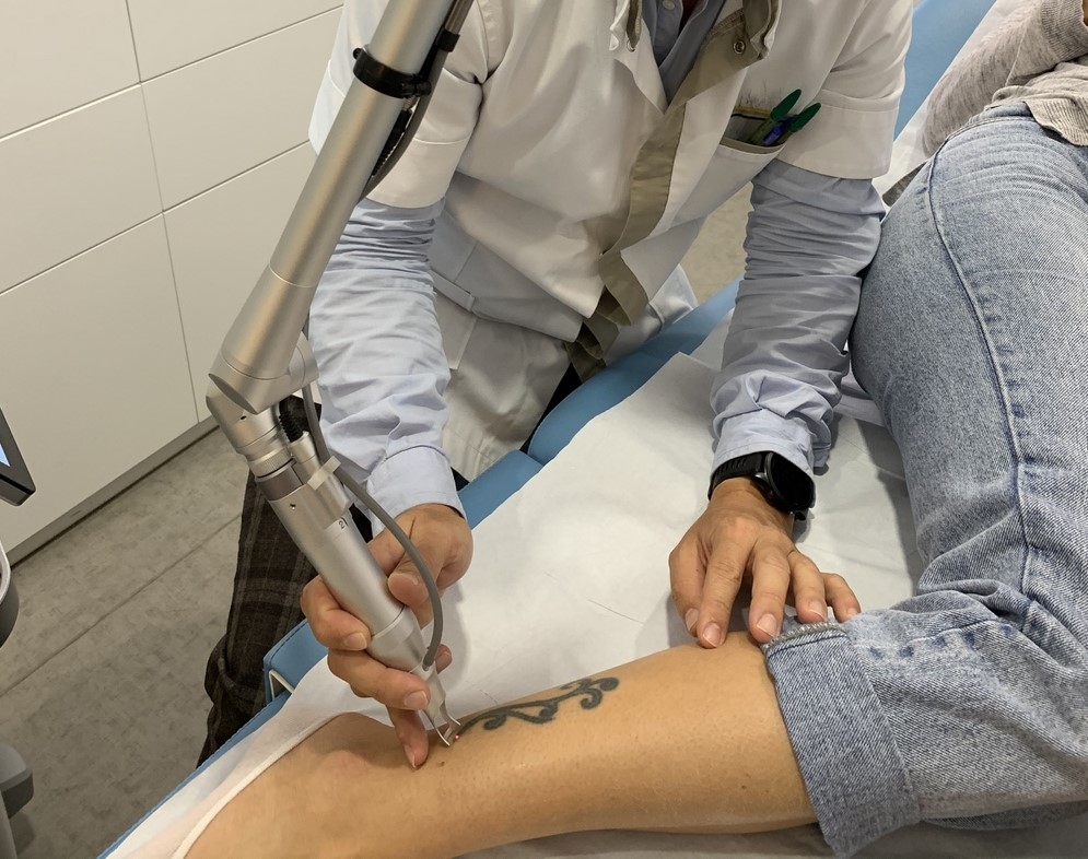 Détatouage laser à Villefranche