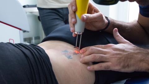 Quel est le coût moyen du détatouage laser à Villefranche ?