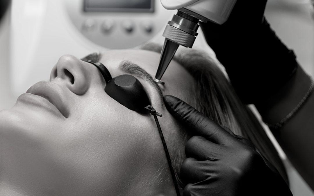 Les facteurs influençant la réussite d’un détatouage laser à Villefranche