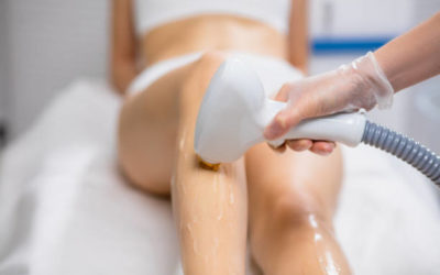 Quels sont les tarifs moyens pour une épilation laser à Villefranche ?
