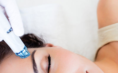 L’Hydrafacial à Lyon est-il efficace contre l’acné pour les patients  ?