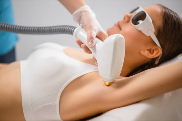 épilation laser à Villefranche