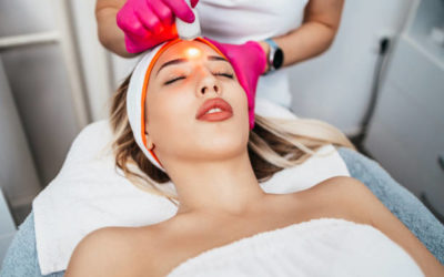 Le laser de rajeunissement est‑il douloureux ?