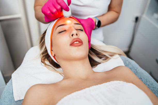 Le laser de rajeunissement est‑il douloureux ?
