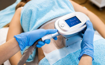 Comment la cryolipolyse à Villefranche agit-elle sur la texture de la peau ?