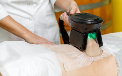 La cryolipolyse à Villefranche est-elle une solution pour perdre quelques centimètres de tour de taille ?