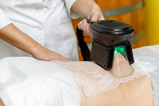 La cryolipolyse à Villefranche est-elle une solution pour perdre quelques centimètres de tour de taille ?