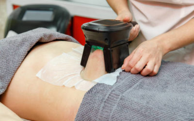 En quoi la cryolipolyse à Villefranche complète-t-elle un programme minceur classique ?