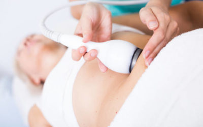 Quels conseils personnalisés sont donnés après une cryolipolyse à Villefranche ?