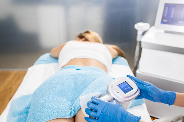 Pourquoi la cryolipolyse à Villefranche est-elle considérée comme un soin de finition ?