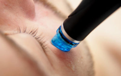 Comment choisir un bon praticien pour un hydrafacial à Lyon en toute sécurité ?