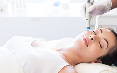 Un hydrafacial à Lyon est-il efficace contre les points noirs et les impuretés tenaces ?