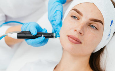 Peut-on avoir des rougeurs juste après un hydrafacial à Lyon ?