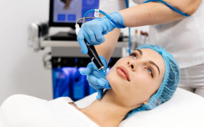 L’hydrafacial à Lyon est-il adapté après un été au soleil ou une peau déshydratée ?