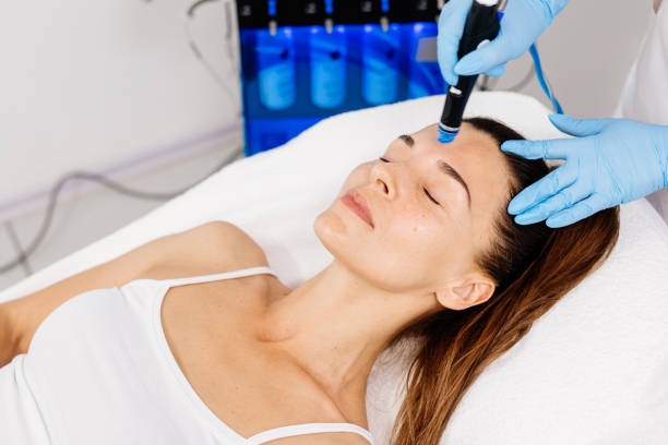 L’hydrafacial à Lyon est-il efficace contre les points noirs ?