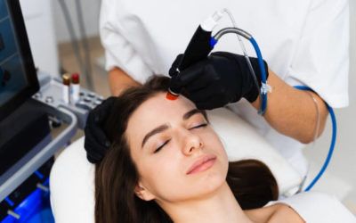 Un hydrafacial à Lyon peut-il améliorer les ridules autour des yeux ?